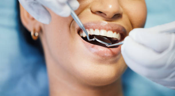 Best Emergency Tooth Extraction in Greentown, OH